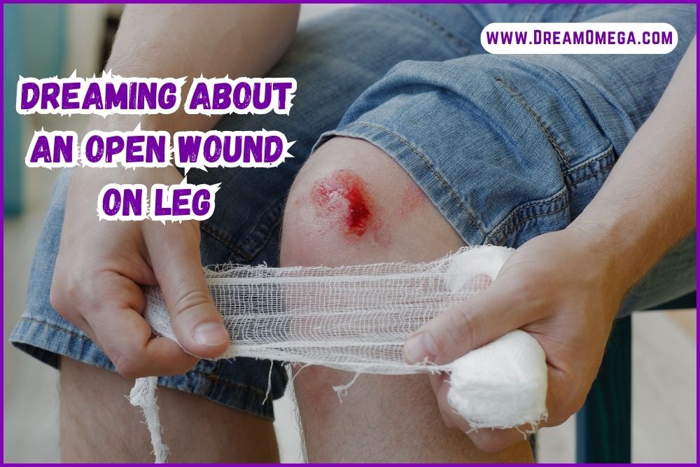 Dreaming About an Open Wound on Leg